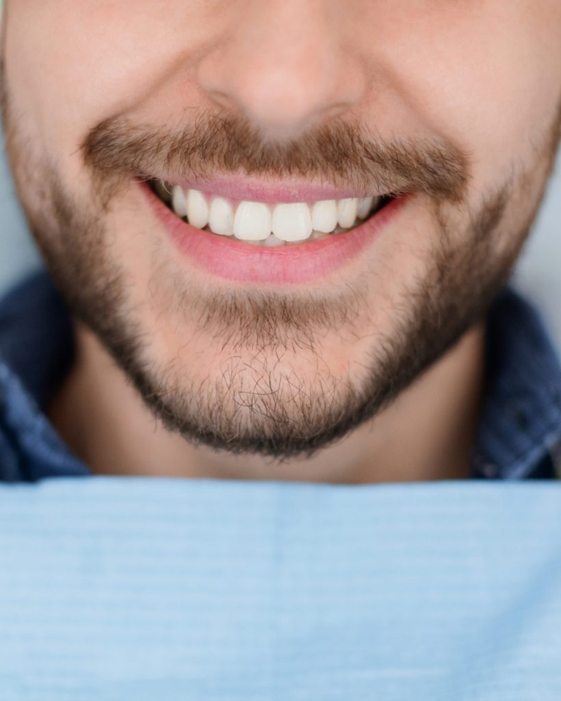 Closeup of man dental clinic patient white healthy smile, unrecognizable bearded man with napkin on his chest showing his beautiful smile, showing result of treatment at modern dentistry, cropped