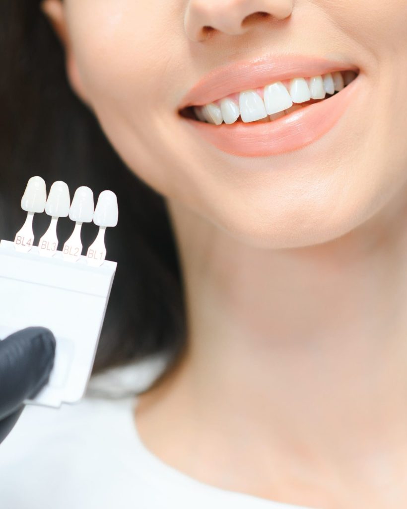 doctor-matching-patient-s-teeth-color-with-palette-2026-01-08-23-56-13-utc (1)